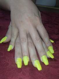 img1